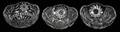 071538 CUT GLASS BOWLS EARLY 20TH C THREE DIA 8