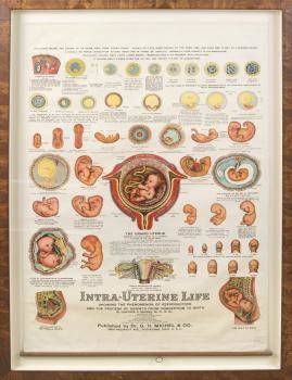 ZAPPA INTRAUTERINE LIFE POSTER