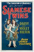 Siamese Twins Daisy and Violet Hilton Kansas City