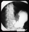 JOHN F KENNEDY RADIOGRAPH 2