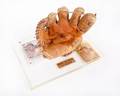 BURT REYNOLDS DICK HOWSER BASEBALL GLOVE DISPLAY