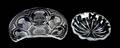 Two Lalique Molded and Frosted Glass Dishes