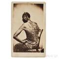 CartedeVisite of Enslaved Man with Whipping Scars Escaped Slave Known as Gordon or Peter